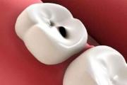 Prečo snívate o zhnitých zuboch: výklad z rôznych kníh snov