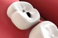 К чему снятся гнилые зубы: толкование по различным сонникам