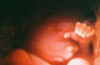 týždeň tehotenstva – čo sa deje s bábätkom