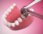 Proces hojenia ďasien po extrakcii zubov Ako môžete obnoviť oud