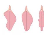 Ak sú malé stydké pysky veľké, sú to dobré alebo zlé, prečo sú to veľké stydké pysky u žien