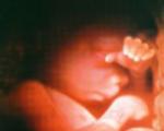 týždeň tehotenstva – čo sa deje s bábätkom